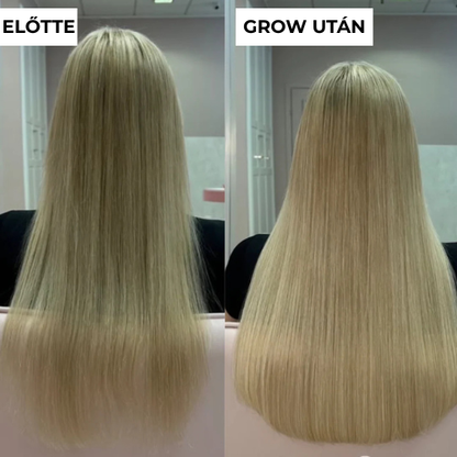 GROW-Arany mikrotűs hajnővesztő kezelés