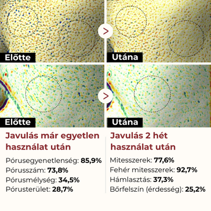 Dr. Melaxin-Koreai Rizs Kivonatos Hámlasztó szérum