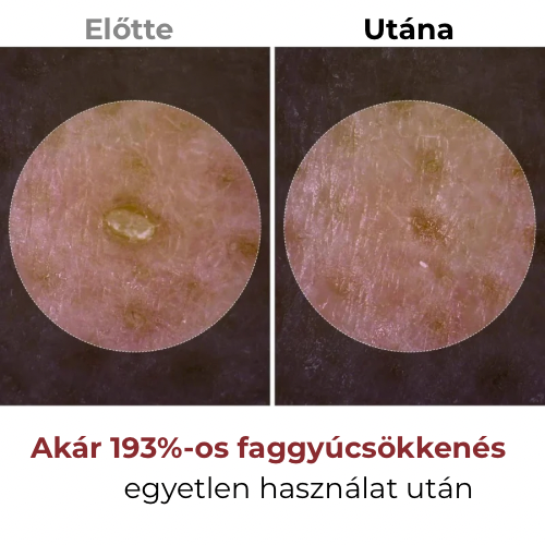 Dr. Melaxin-Koreai Rizs Kivonatos Hámlasztó szérum